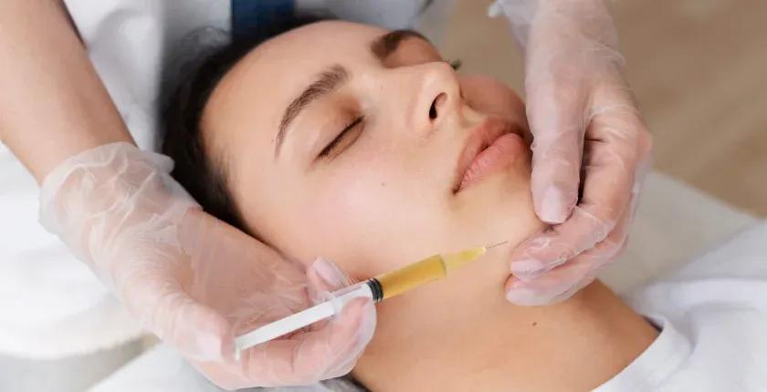 Precision Dermal Filler Treatment at Redefyne Clinic